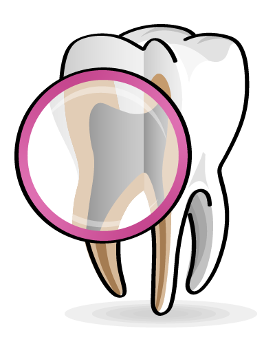 Endodoncia